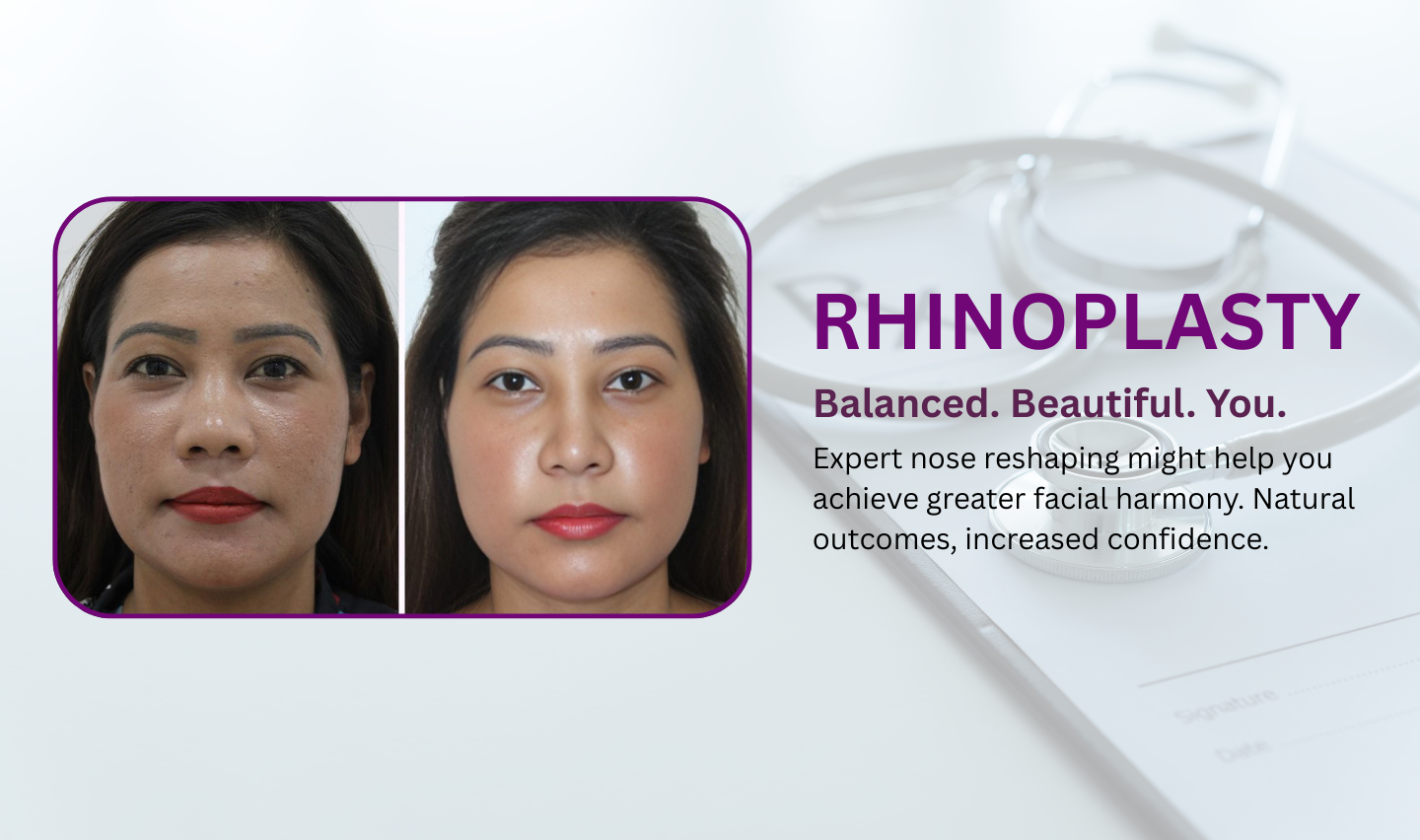 RHino